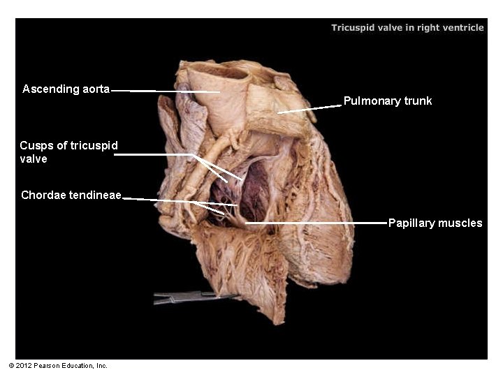 Ascending aorta Pulmonary trunk Cusps of tricuspid valve Chordae tendineae Papillary muscles © 2012