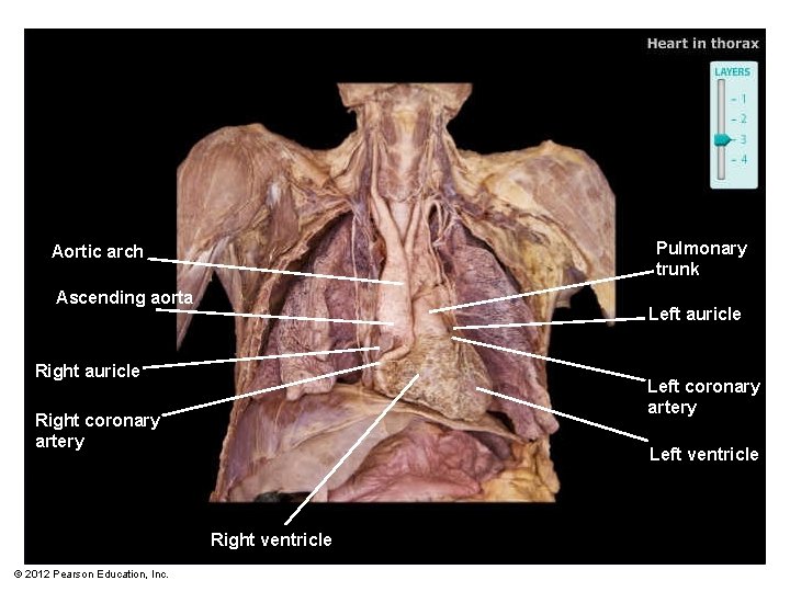 Pulmonary trunk Aortic arch Ascending aorta Left auricle Right auricle Left coronary artery Right