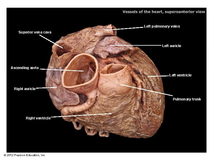 Left pulmonary veins Superior vena cava Left auricle Ascending aorta Left ventricle Right auricle