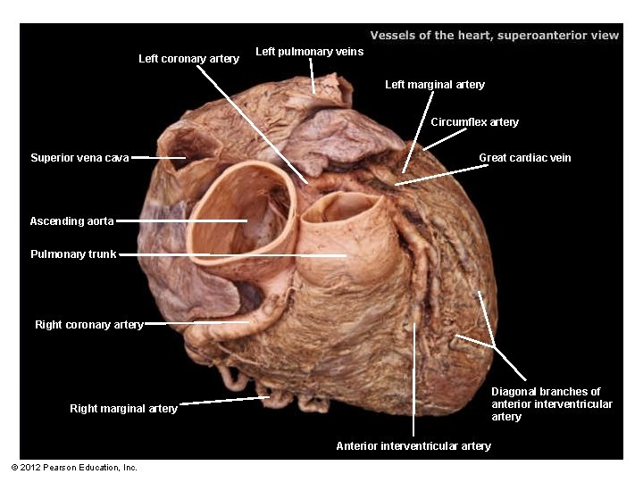 Left coronary artery Left pulmonary veins Left marginal artery Circumflex artery Superior vena cava