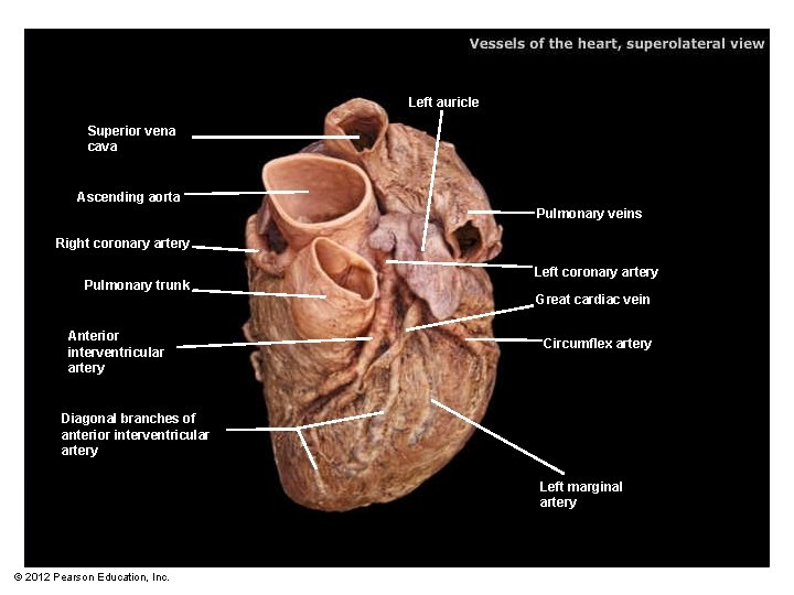 Left auricle Superior vena cava Ascending aorta Pulmonary veins Right coronary artery Pulmonary trunk