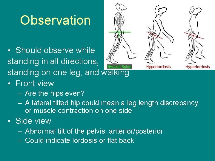 Observation • Should observe while standing in all directions, standing on one leg, and