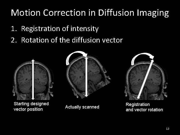 Motion Correction in Diffusion Imaging 1. Registration of intensity 2. Rotation of the diffusion Motion Correction in Diffusion Imaging 1. Registration of intensity 2. Rotation of the diffusion