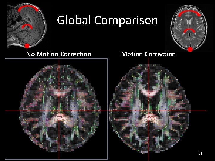 Global Comparison No Motion Correction 14 Global Comparison No Motion Correction 14