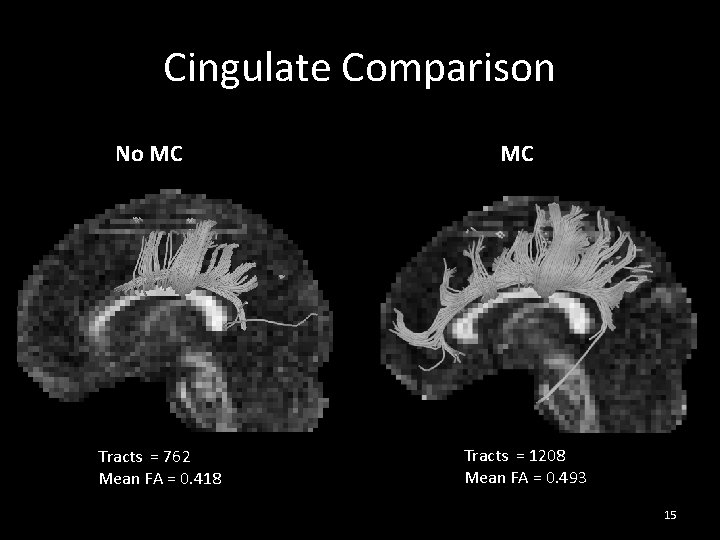 Cingulate Comparison No MC Tracts = 762 Mean FA = 0. 418 MC Tracts Cingulate Comparison No MC Tracts = 762 Mean FA = 0. 418 MC Tracts