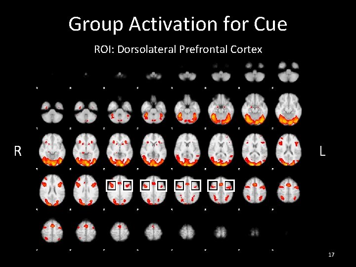 Group Activation for Cue ROI: Dorsolateral Prefrontal Cortex R L 17 Group Activation for Cue ROI: Dorsolateral Prefrontal Cortex R L 17