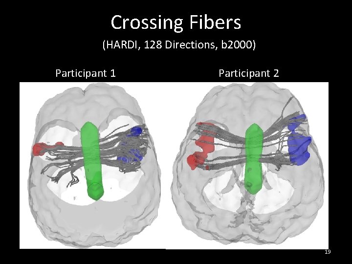 Crossing Fibers (HARDI, 128 Directions, b 2000) Participant 1 Participant 2 19 Crossing Fibers (HARDI, 128 Directions, b 2000) Participant 1 Participant 2 19