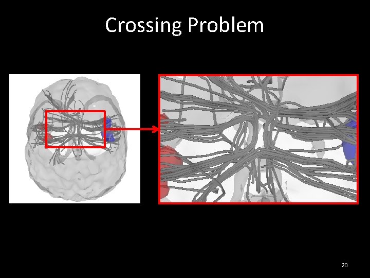 Crossing Problem 20 Crossing Problem 20