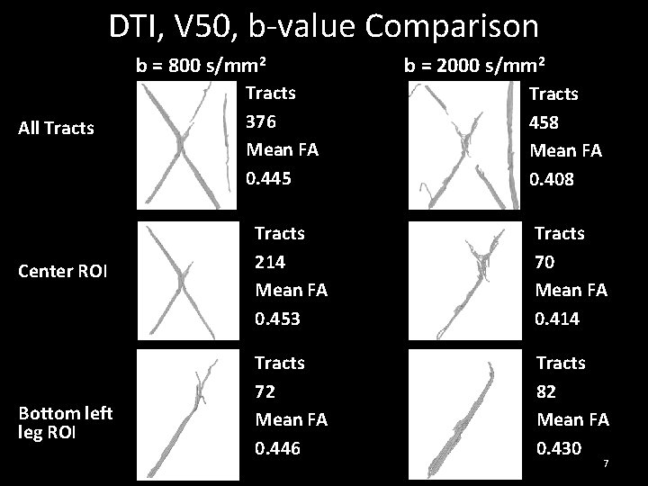 DTI, V 50, b-value Comparison b = 800 s/mm 2 All Tracts Center ROI DTI, V 50, b-value Comparison b = 800 s/mm 2 All Tracts Center ROI