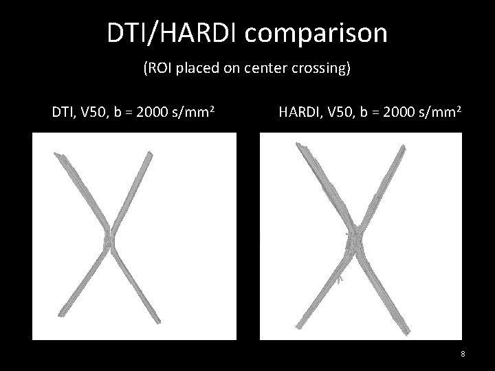 DTI/HARDI comparison (ROI placed on center crossing) DTI, V 50, b = 2000 s/mm DTI/HARDI comparison (ROI placed on center crossing) DTI, V 50, b = 2000 s/mm