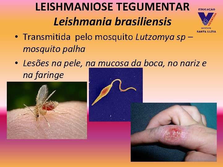 LEISHMANIOSE TEGUMENTAR Leishmania brasiliensis • Transmitida pelo mosquito Lutzomya sp – mosquito palha • LEISHMANIOSE TEGUMENTAR Leishmania brasiliensis • Transmitida pelo mosquito Lutzomya sp – mosquito palha •