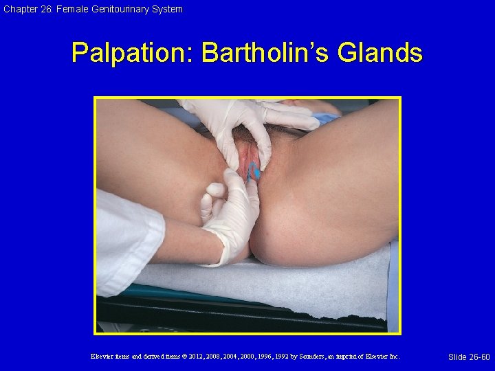 Chapter 26: Female Genitourinary System Palpation: Bartholin’s Glands Elsevier items and derived items ©