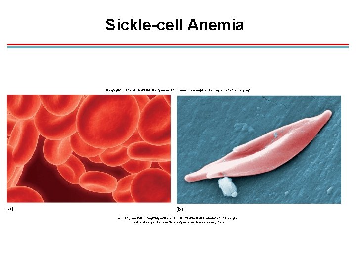 Sickle-cell Anemia Copyright © The Mc. Graw-Hill Companies, Inc. Permission required for reproduction or
