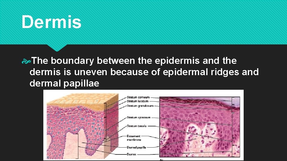 Dermis The boundary between the epidermis and the dermis is uneven because of epidermal