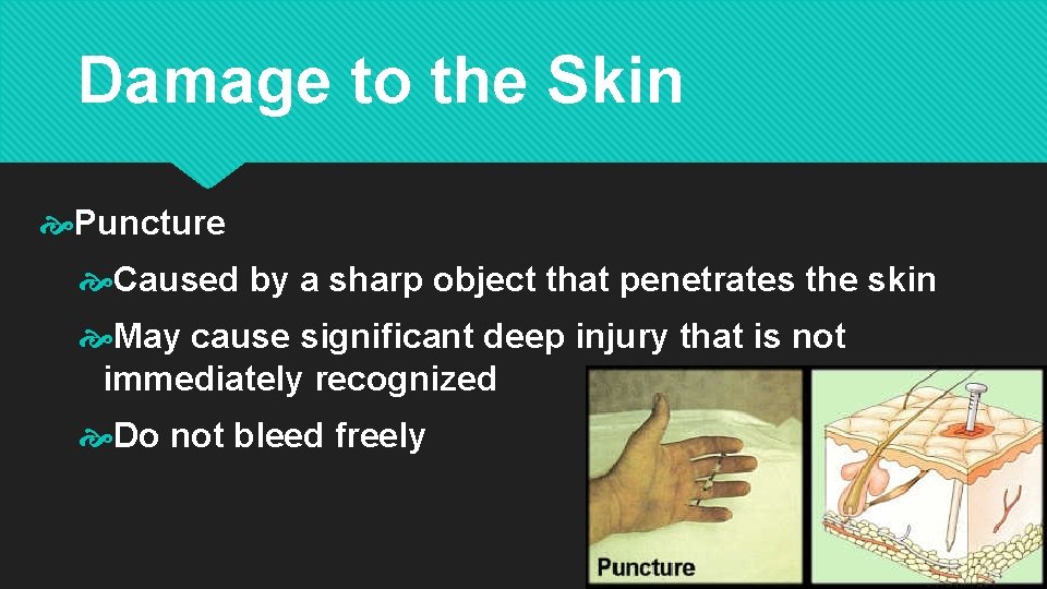 Damage to the Skin Puncture Caused by a sharp object that penetrates the skin