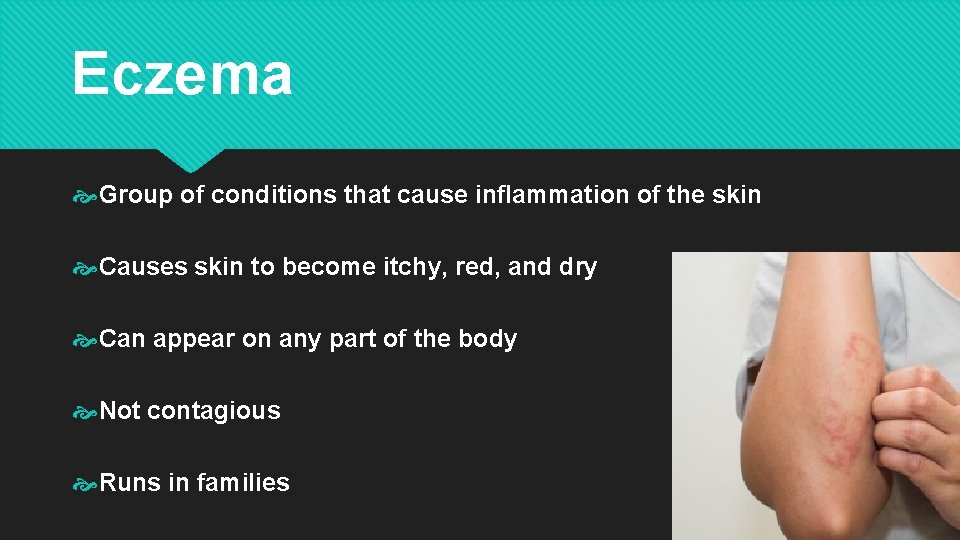 Eczema Group of conditions that cause inflammation of the skin Causes skin to become