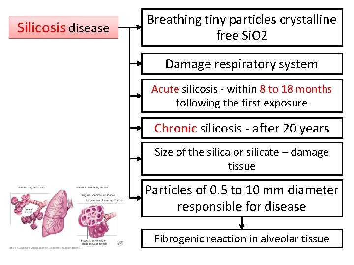 Silicosis disease Breathing tiny particles crystalline free Si. O 2 Damage respiratory system Acute