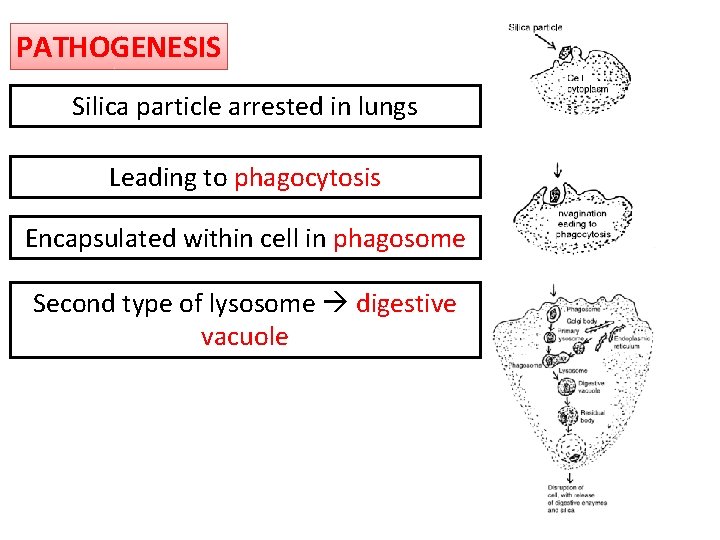 PATHOGENESIS Silica particle arrested in lungs Leading to phagocytosis Encapsulated within cell in phagosome