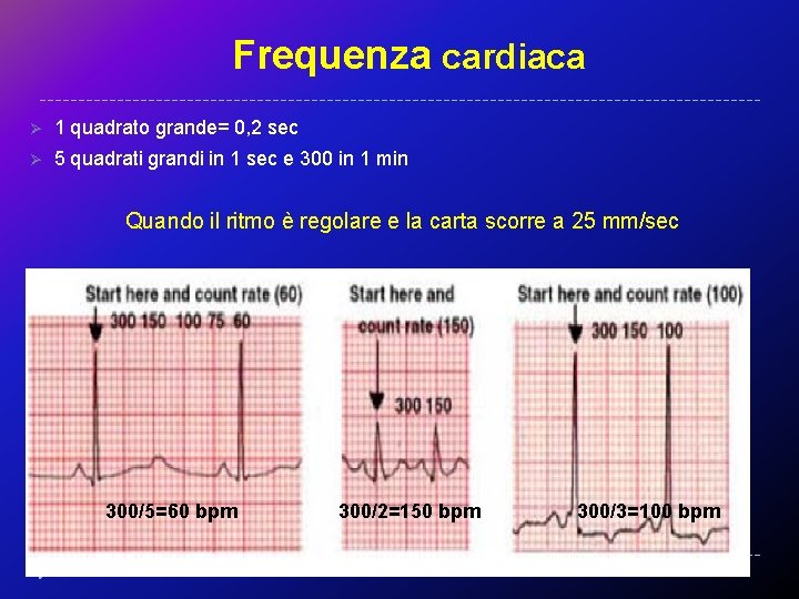 Frequenza cardiaca Ø 1 quadrato grande= 0, 2 sec Ø 5 quadrati grandi in