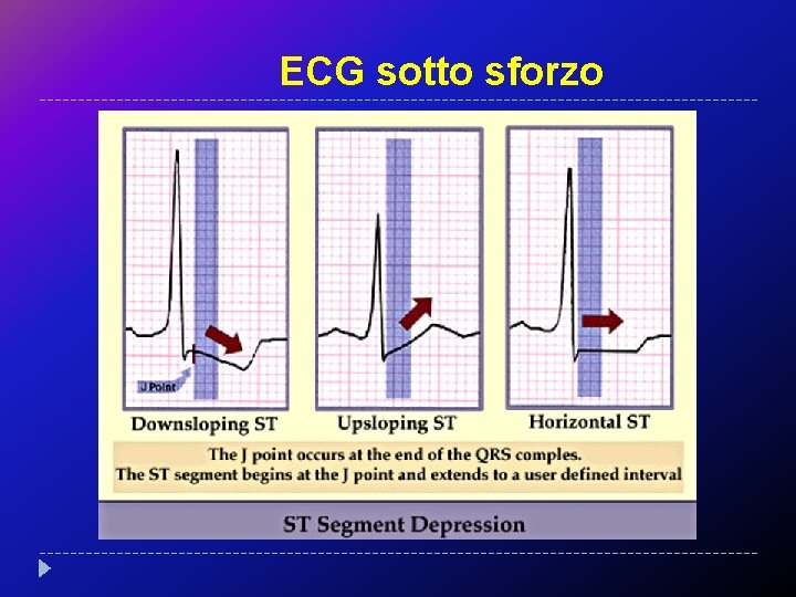 ECG sotto sforzo 