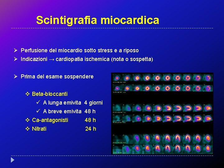 Scintigrafia miocardica Ø Perfusione del miocardio sotto stress e a riposo Ø Indicazioni →