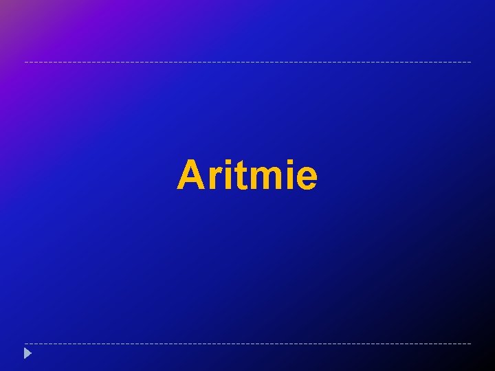 Aritmie 