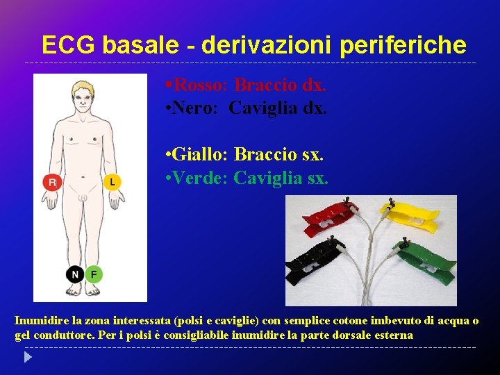 ECG basale - derivazioni periferiche §Rosso: Braccio dx. • Nero: Caviglia dx. • Giallo: