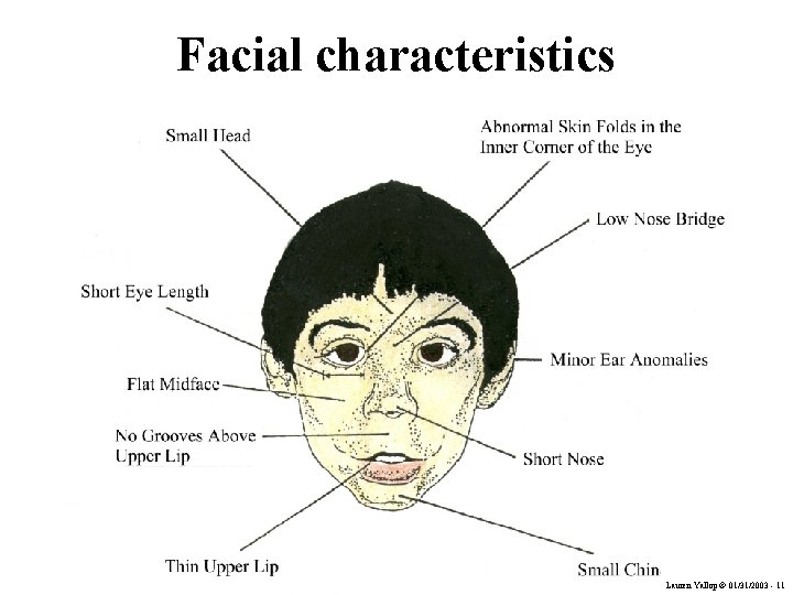 Facial characteristics Lauren Yallop © 01/31/2003 - 11 