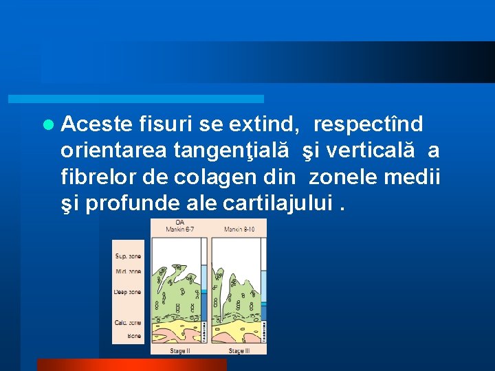 l Aceste fisuri se extind, respectînd orientarea tangenţială şi verticală a fibrelor de colagen