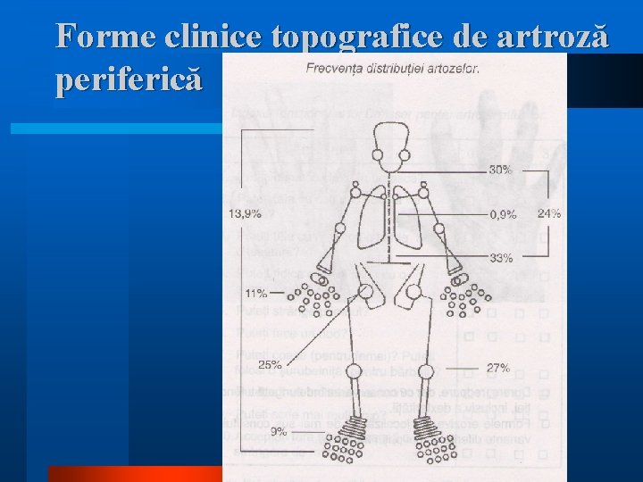 Forme clinice topografice de artroză periferică 