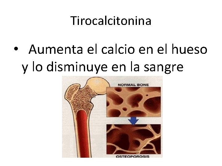 Tirocalcitonina • Aumenta el calcio en el hueso y lo disminuye en la sangre Tirocalcitonina • Aumenta el calcio en el hueso y lo disminuye en la sangre