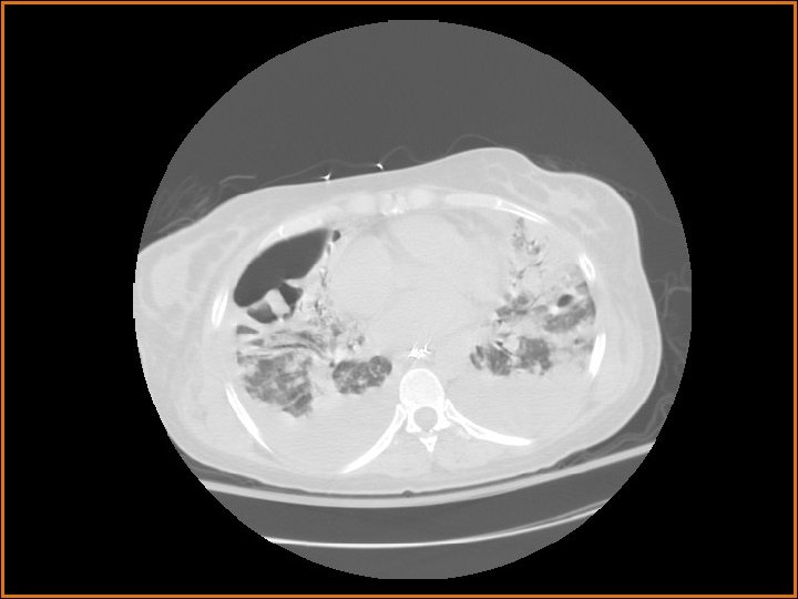 Radiological Presentations 