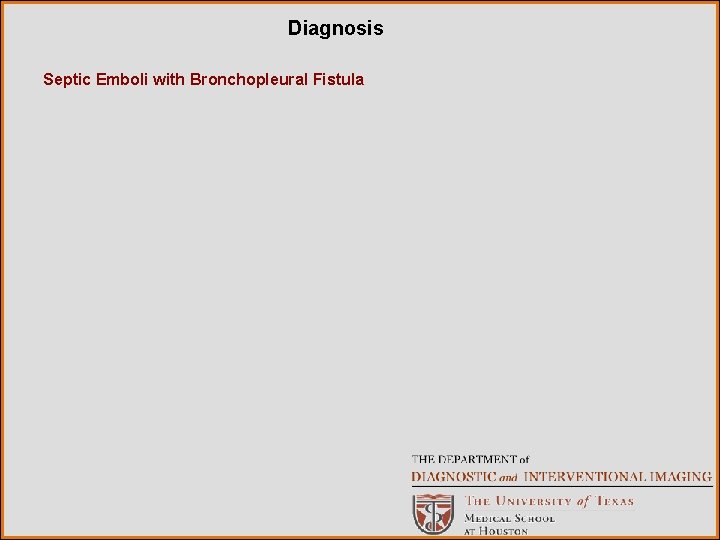 Diagnosis Septic Emboli with Bronchopleural Fistula 