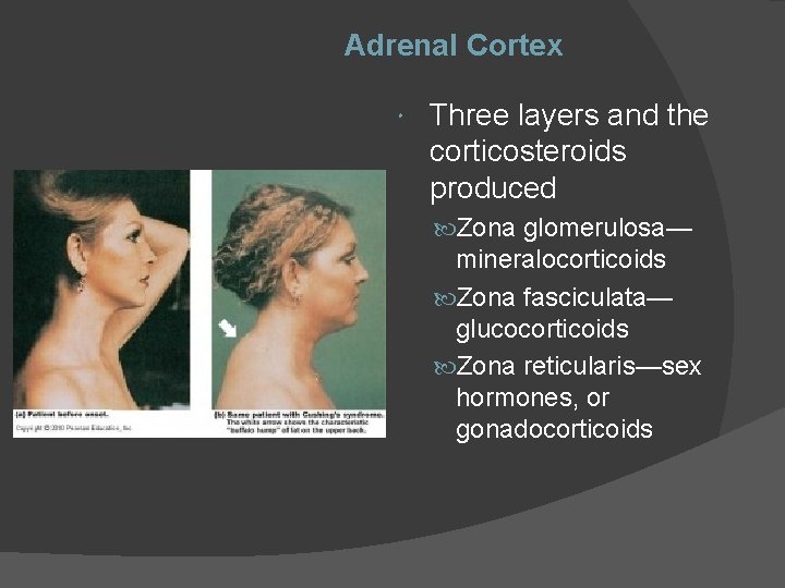 Adrenal Cortex Three layers and the corticosteroids produced Zona glomerulosa— mineralocorticoids Zona fasciculata— glucocorticoids