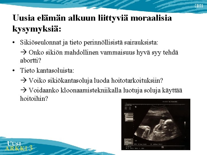 Uusia elämän alkuun liittyviä moraalisia kysymyksiä: • Sikiöseulonnat ja tieto perinnöllisistä sairauksista: Onko sikiön