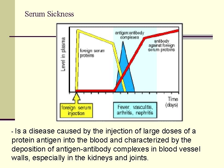 Serum Sickness - Is a disease caused by the injection of large doses of