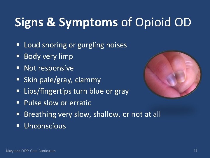 Signs & Symptoms of Opioid OD § § § § Loud snoring or gurgling