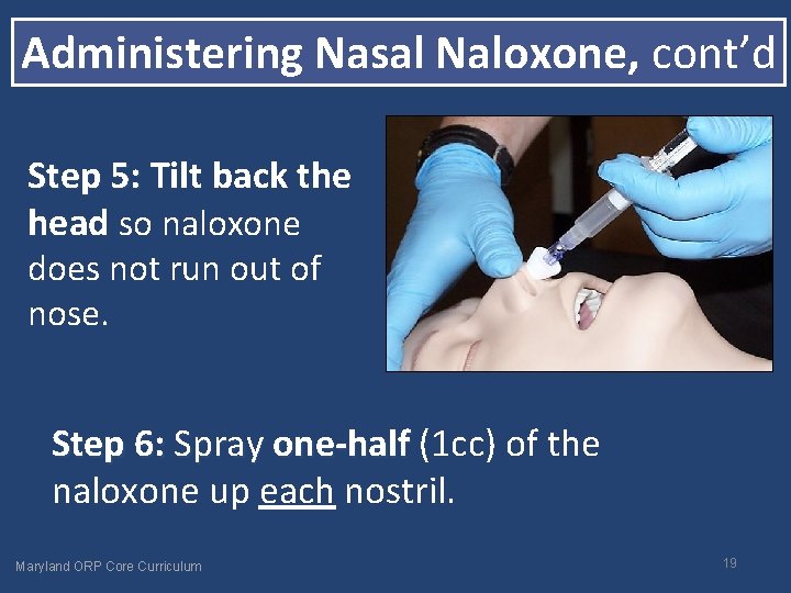 Administering Nasal Naloxone, cont’d Step 5: Tilt back the head so naloxone does not