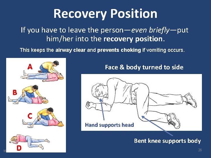 Recovery Position If you have to leave the person—even briefly—put him/her into the recovery