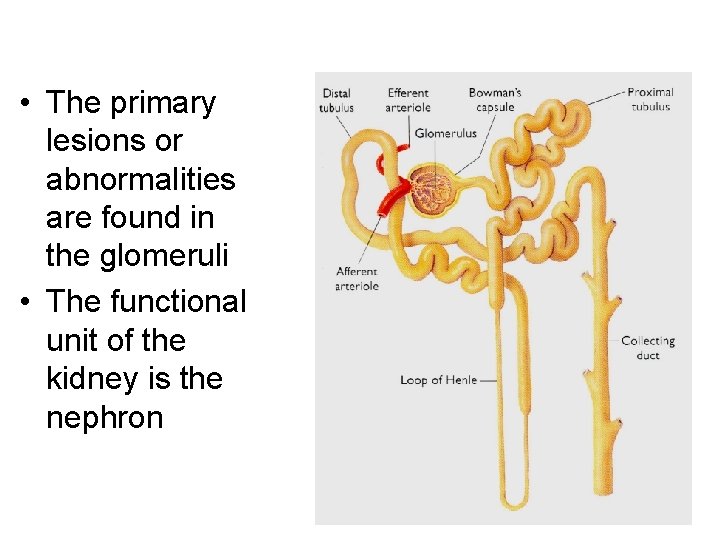  • The primary lesions or abnormalities are found in the glomeruli • The