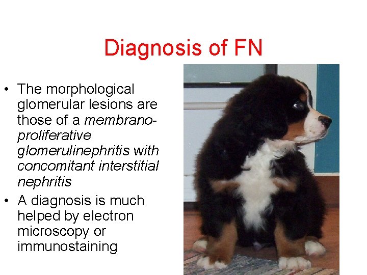 Diagnosis of FN • The morphological glomerular lesions are those of a membranoproliferative glomerulinephritis