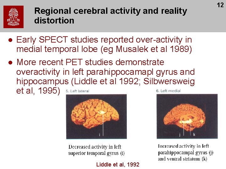 Regional cerebral activity and reality distortion l l Early SPECT studies reported over-activity in