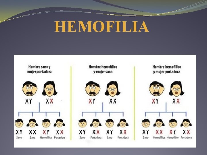 HEMOFILIA HEMOFILIA