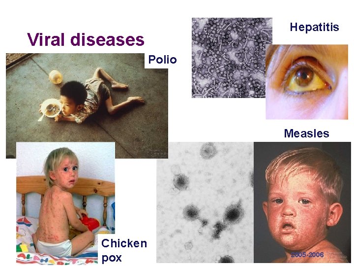 Hepatitis Viral diseases Polio Measles Chicken pox 2005 -2006 