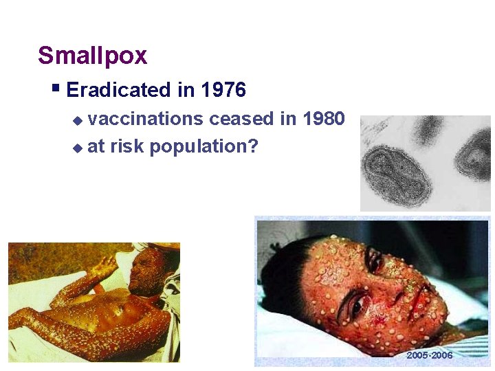 Smallpox § Eradicated in 1976 vaccinations ceased in 1980 u at risk population? u