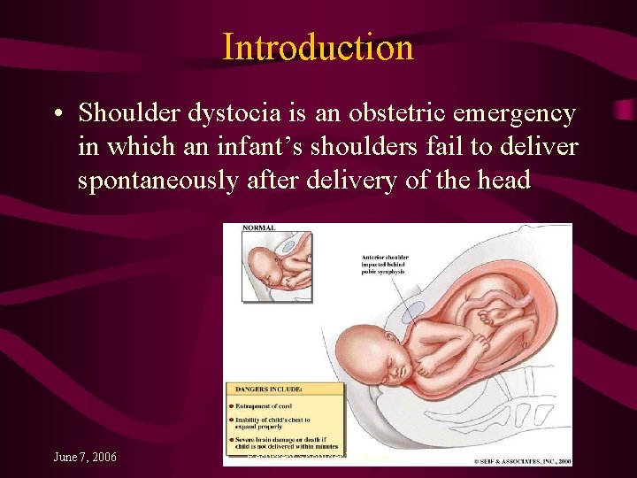 Introduction • Shoulder dystocia is an obstetric emergency in which an infant’s shoulders fail