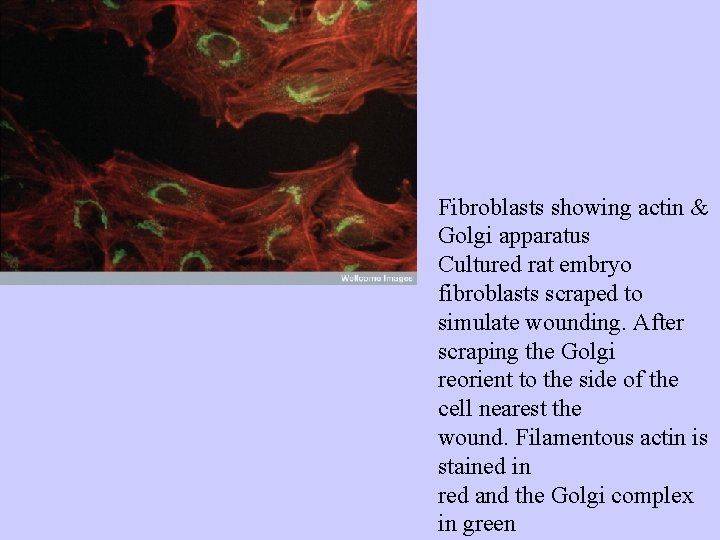 Fibroblasts showing actin & Golgi apparatus Cultured rat embryo fibroblasts scraped to simulate wounding.