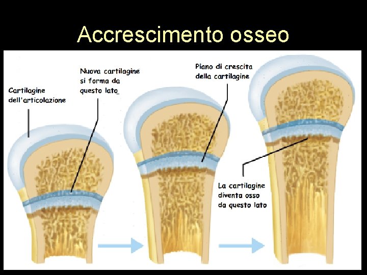 Accrescimento osseo 