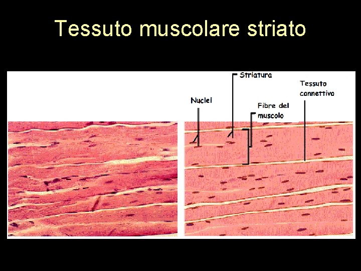 Tessuto muscolare striato 