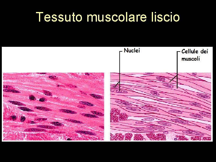 Tessuto muscolare liscio 